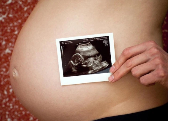 Seltenes Phänomen „Fetus in fetu“: Baby kommt mit Fötus im Bauch zur Welt